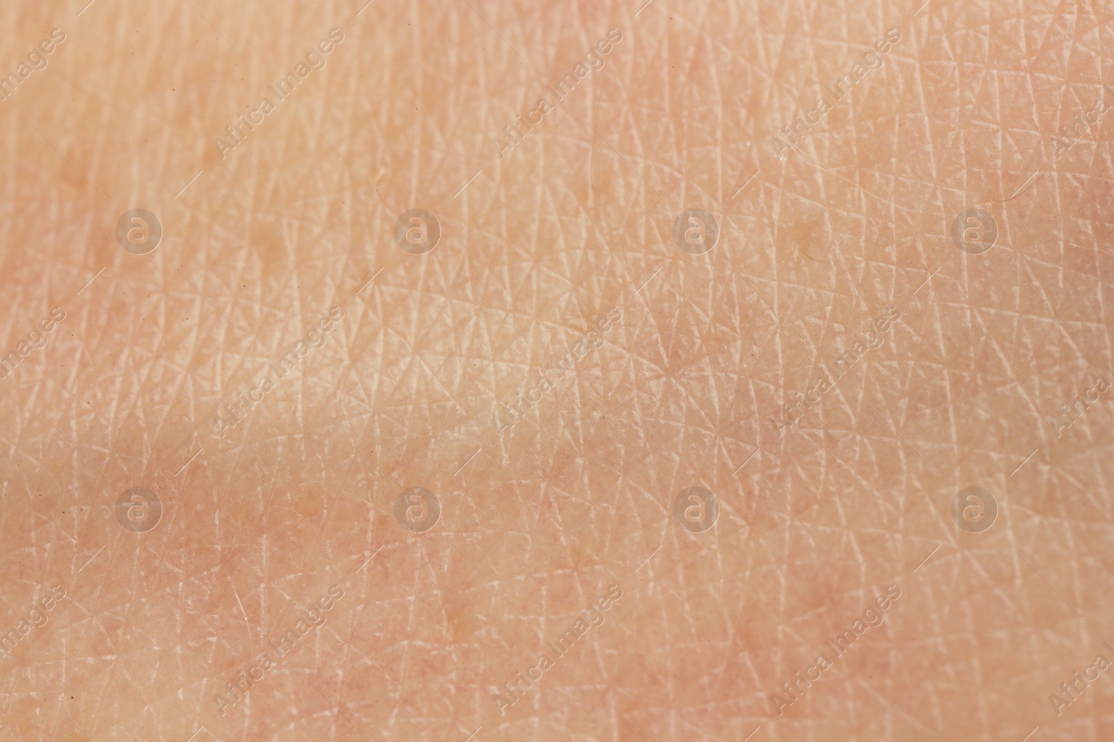 Photo of Texture of dry skin as background, macro view