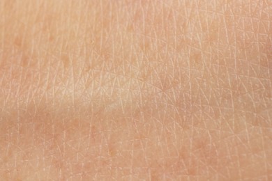 Photo of Texture of dry skin as background, macro view