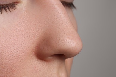 Photo of Young woman with acne problem on grey background, closeup view of nose. Space for text