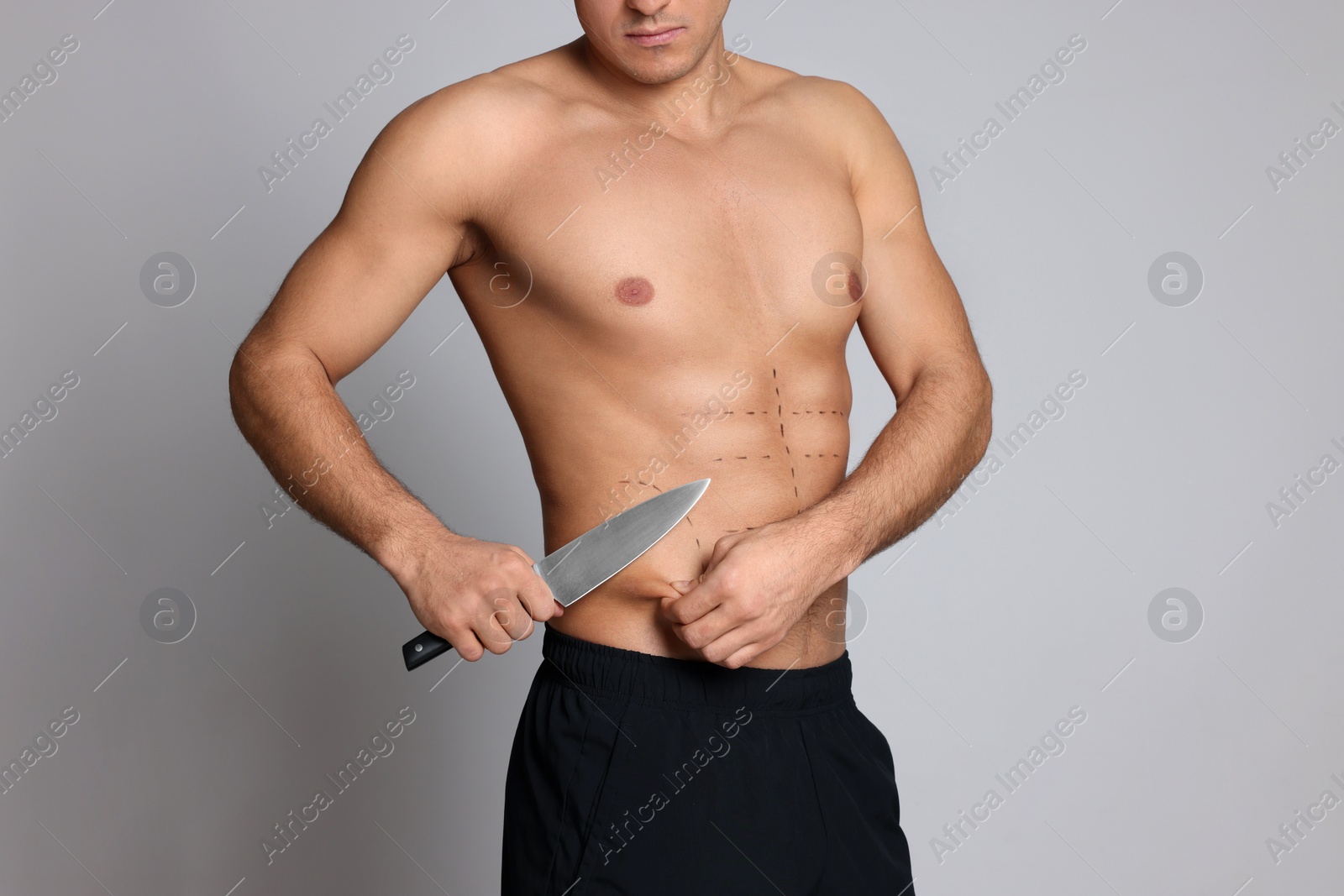 Photo of Fit man with knife and marks on body against grey background, closeup. Weight loss surgery