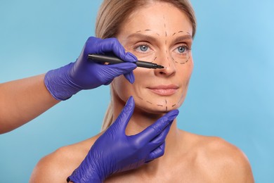 Doctor with marker preparing patient for cosmetic surgery operation on light blue background, closeup
