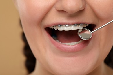 Photo of Examination of woman's teeth with braces using dental mirror on brown background, closeup