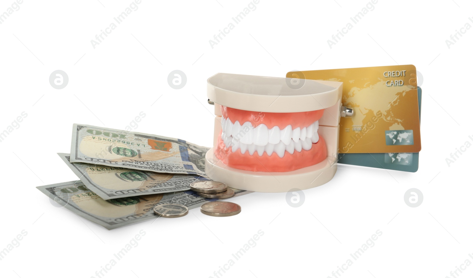 Photo of Educational dental typodont model, money and credit cards on white background. Expensive treatment