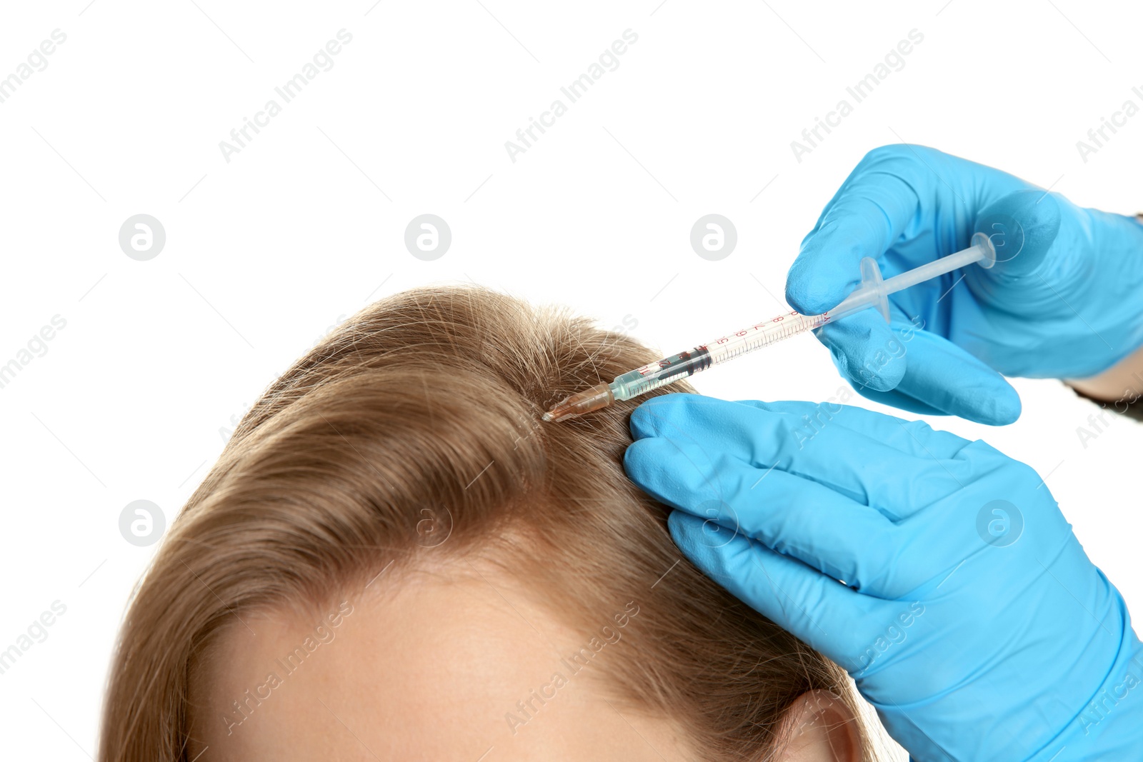 Photo of Young woman with hair loss problem receiving injection on white background, closeup