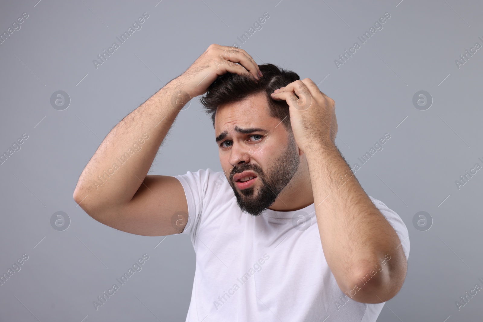 Photo of Emotional man examining his head on light grey background. Dandruff problem