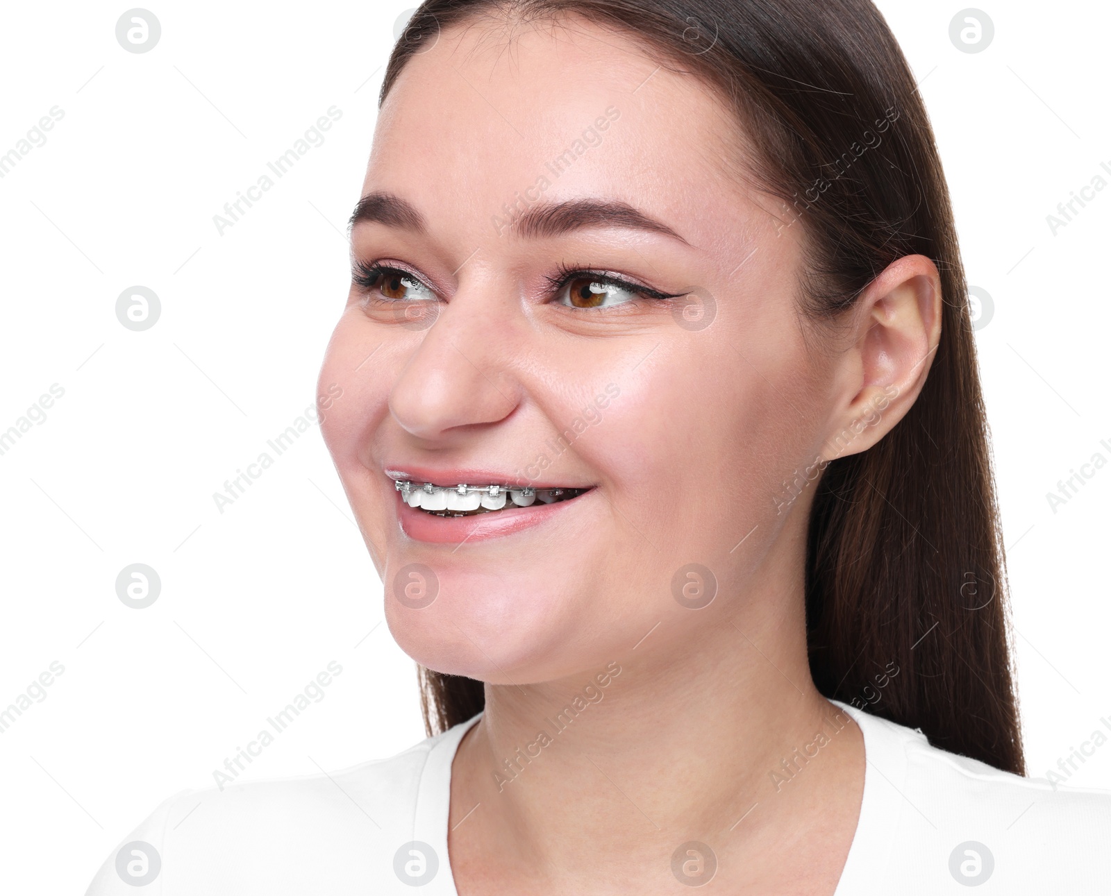 Photo of Smiling woman with dental braces on white background