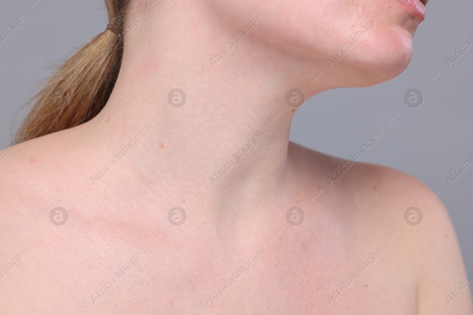 Photo of Closeup view of woman with normal skin on grey background