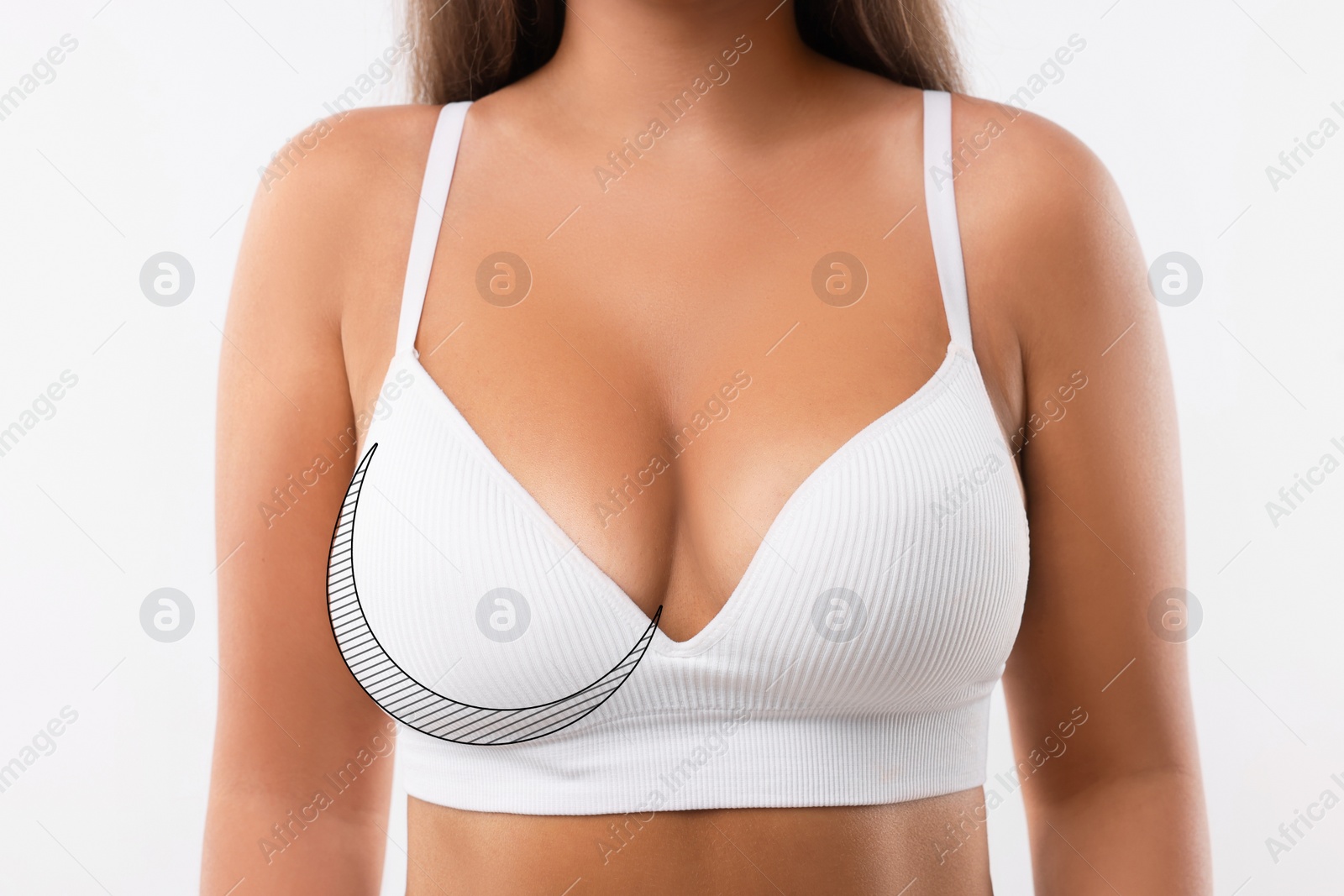 Image of Woman with breast asymmetry on white background, closeup