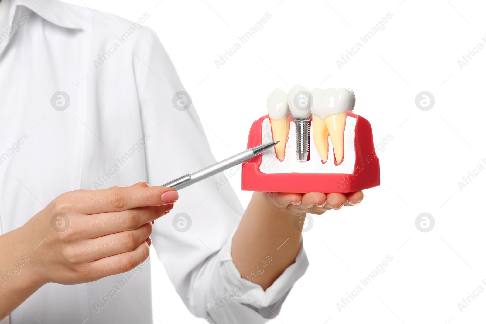 Photo of Dentist holding educational model of dental implant on white background, closeup