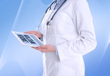 Image of Doctor holding modern tablet with phrase Candida Infection on light blue background, closeup