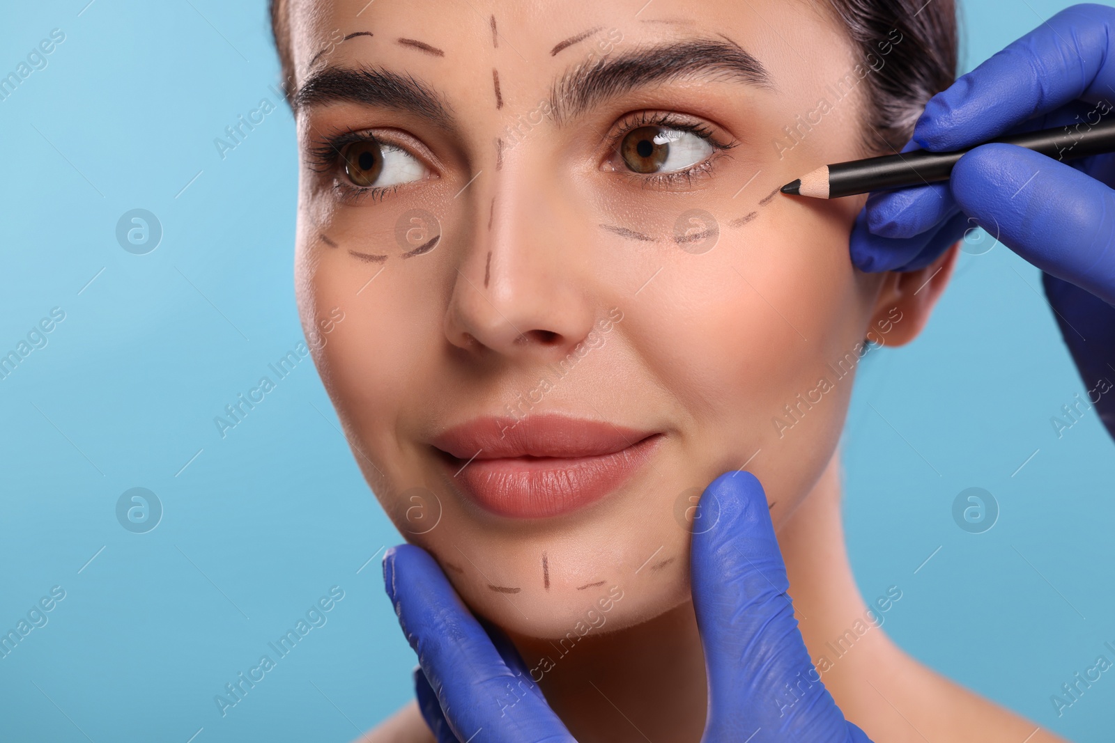 Photo of Doctor drawing marks on woman's face for cosmetic surgery operation against light blue background, closeup