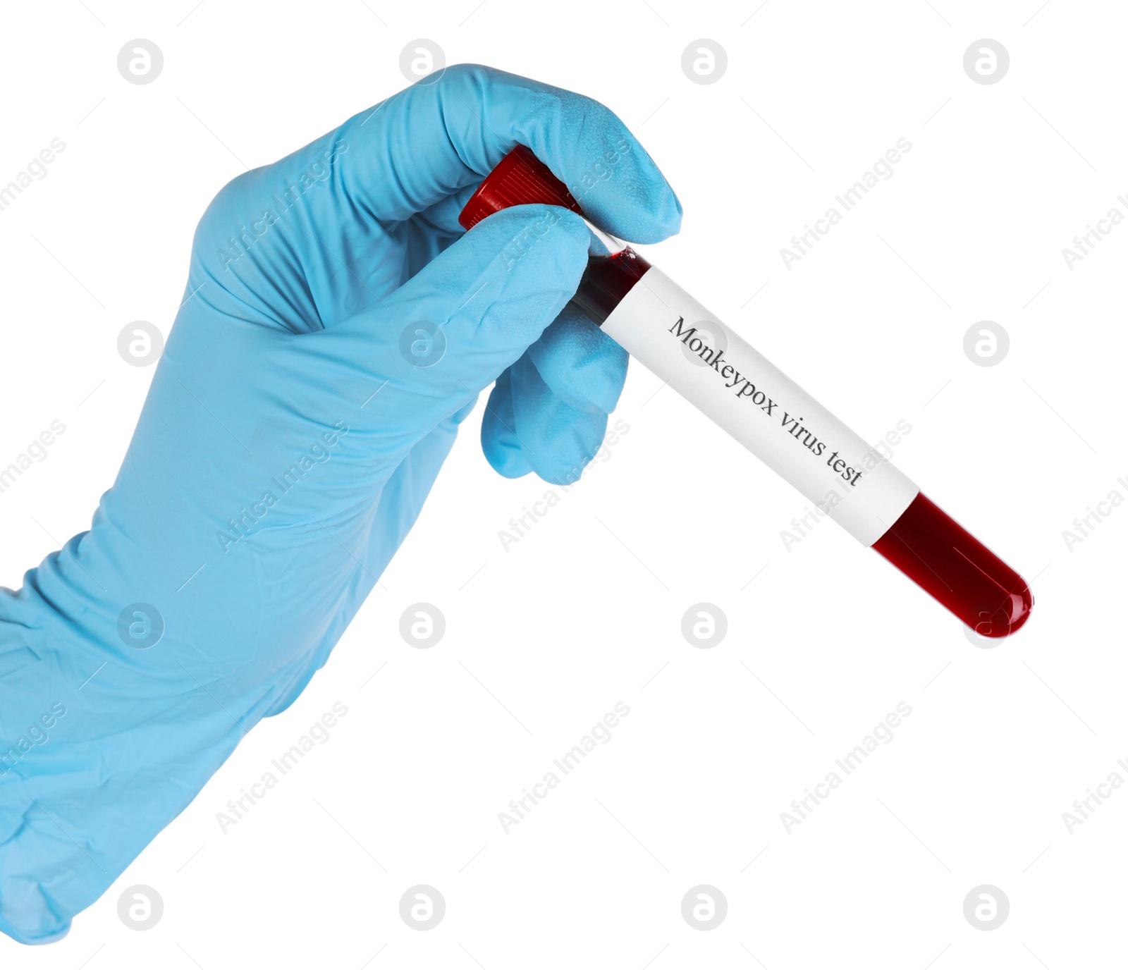 Photo of Monkeypox virus diagnosis. Laboratory worker holding test tube with blood sample on white background, closeup