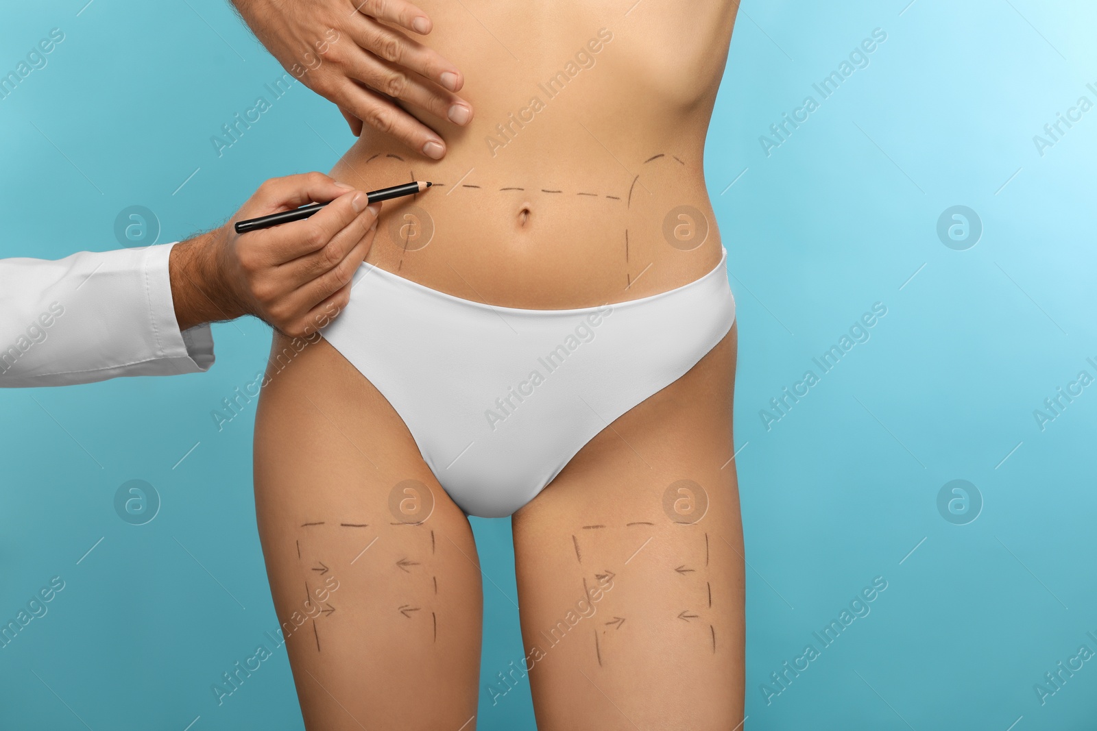 Photo of Doctor with pencil preparing patient for cosmetic surgery operation on light blue background, closeup