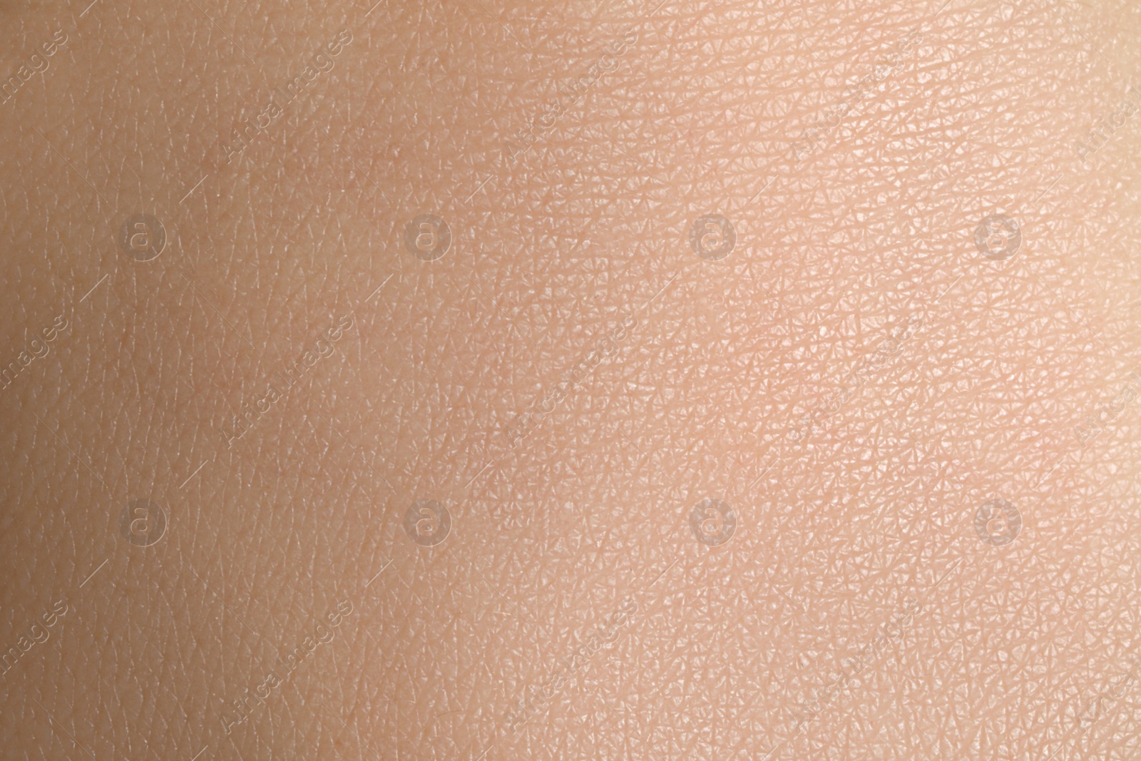 Photo of Closeup view of dry human skin as background