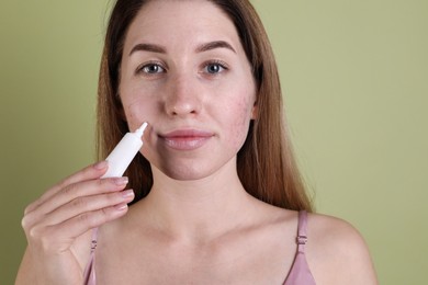 Young woman with acne problem applying cosmetic product onto her skin on olive background