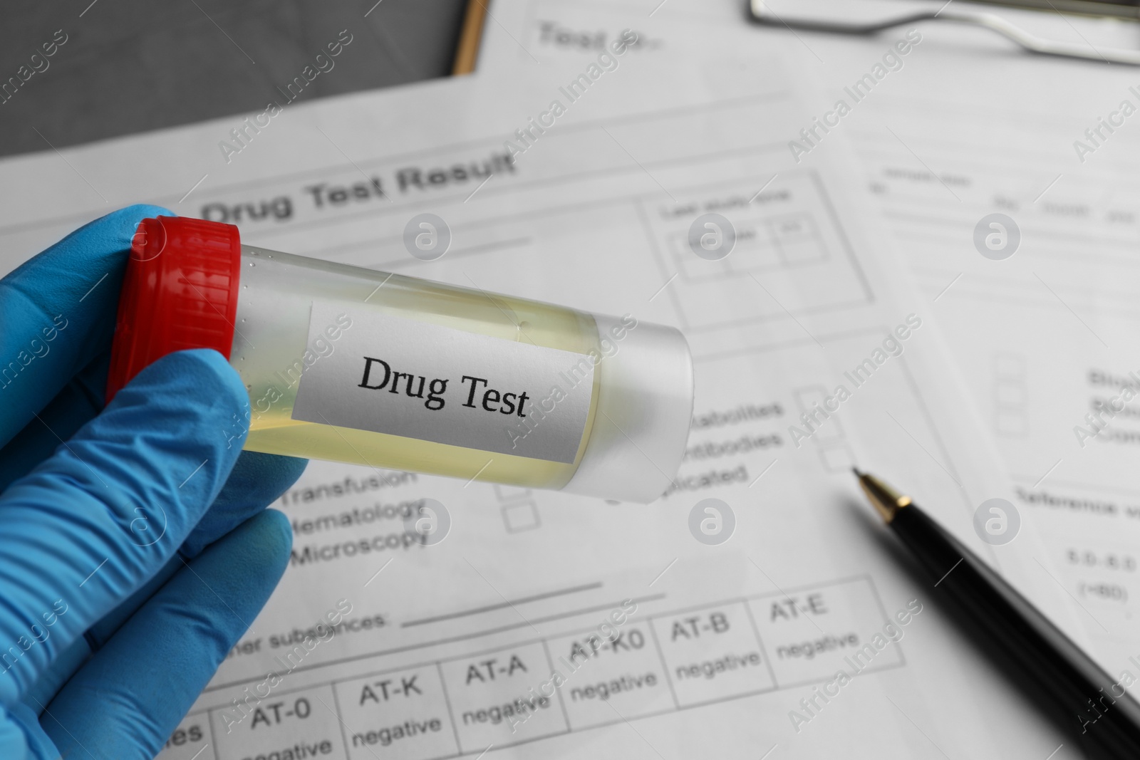 Photo of Drug test. Laboratory worker holding container with urine sample over medical forms on table, closeup