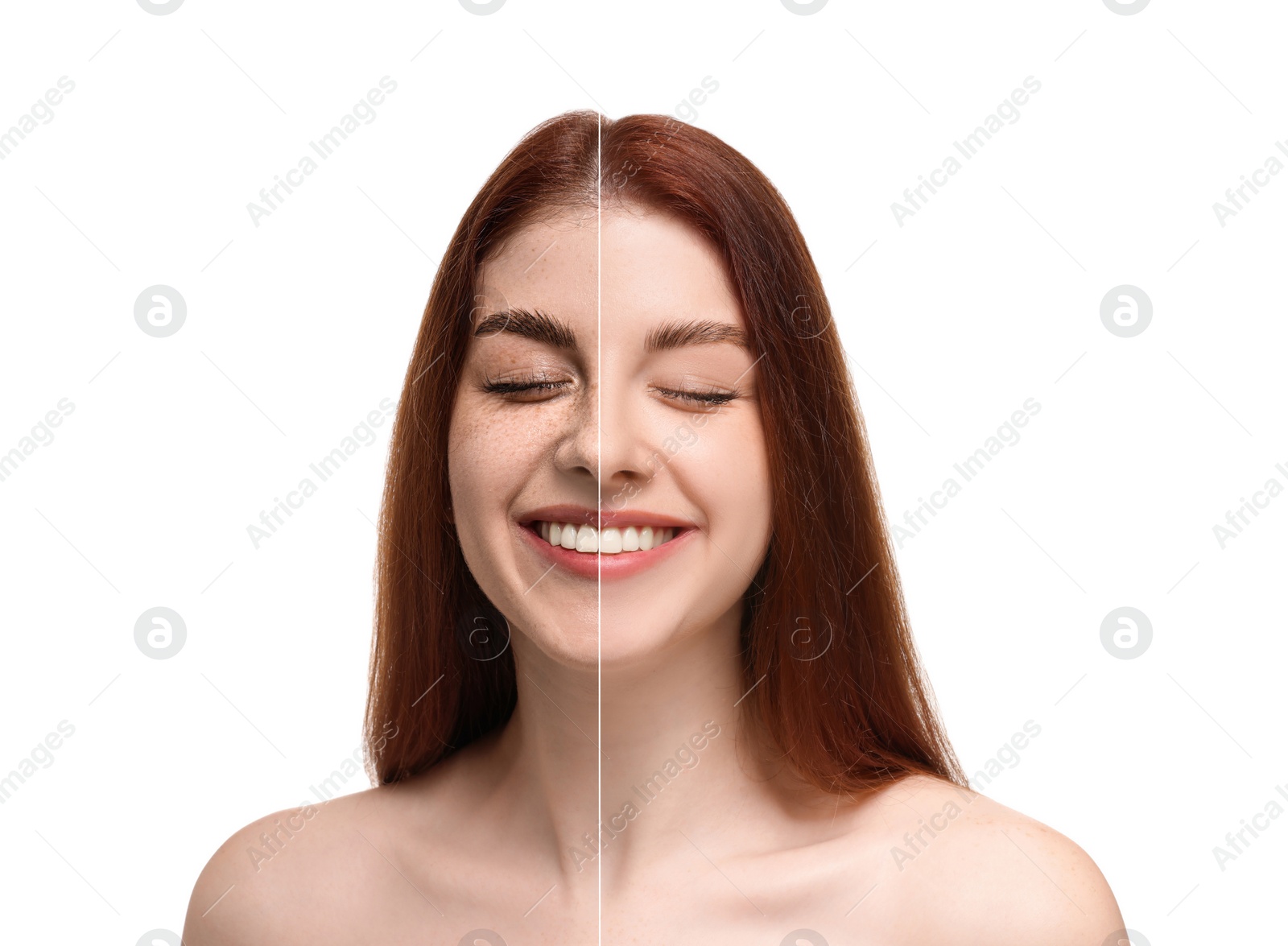 Image of Woman with freckles and clear skin on white background, collage