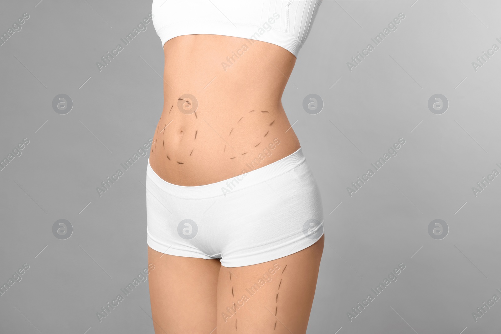 Photo of Young woman with marks on body for cosmetic surgery operation against grey background, closeup