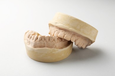 Photo of Dental model with gums on light grey background. Cast of teeth