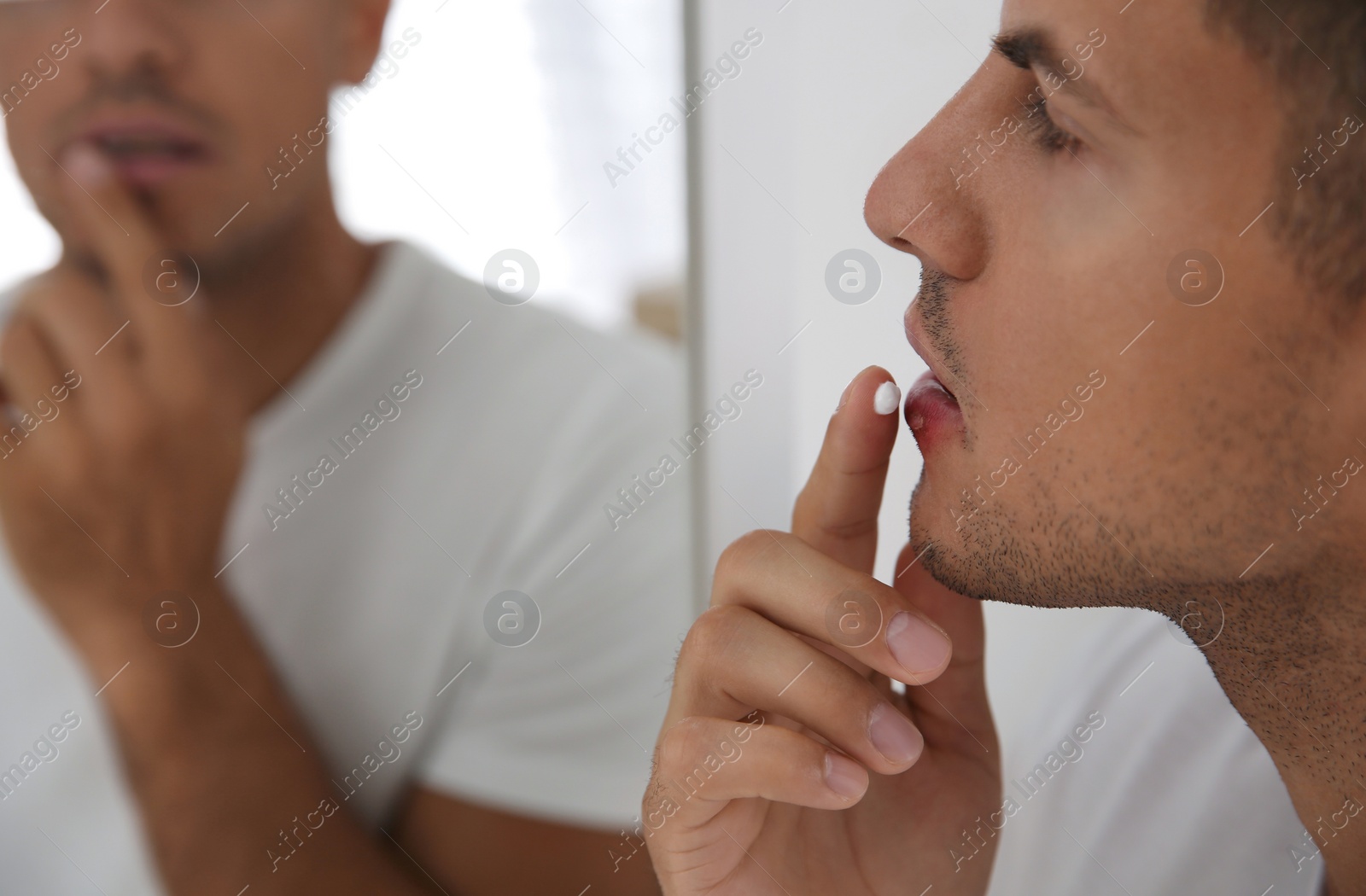 Photo of Man with herpes applying cream on lips in front of mirror, closeup