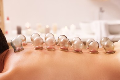 Photo of Cupping therapy. Closeup view of man with glass cups on his back indoors