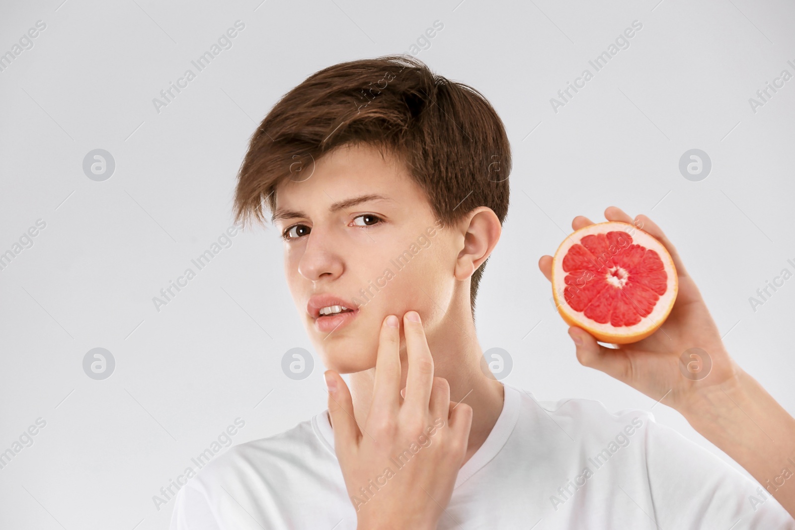 Photo of Teenage boy with acne problem holding grapefruit on light background. Skin allergy