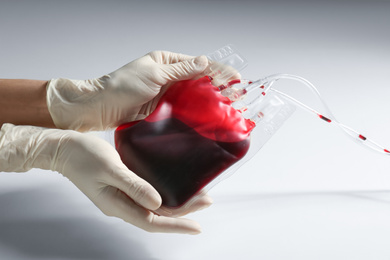 Photo of Woman holding blood for transfusion on light background, closeup. Donation concept