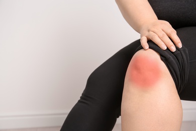 Overweight woman on light background, closeup of legs