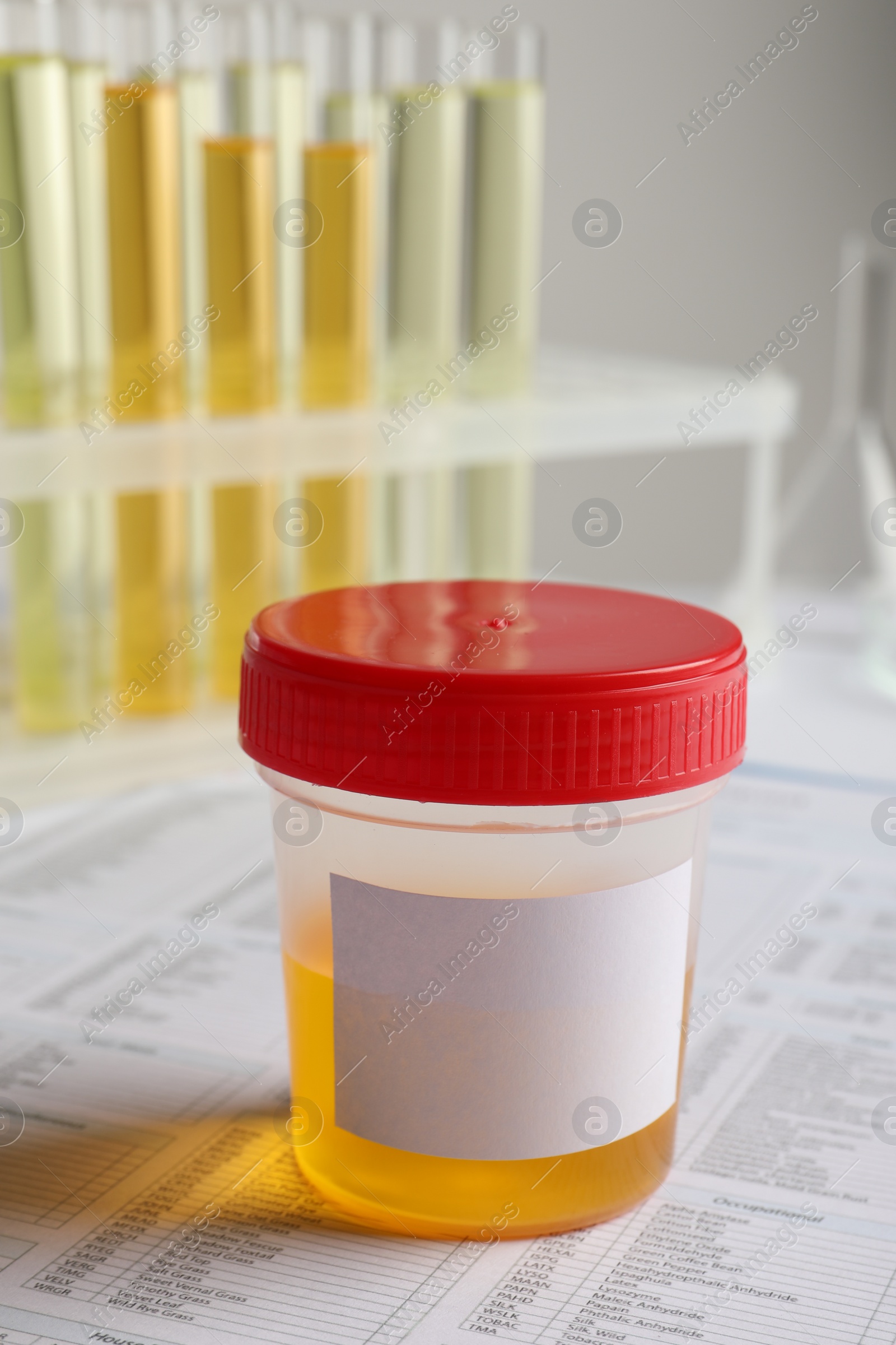 Photo of Container with urine sample for analysis on table