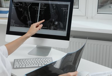 Photo of Doctor examining neck MRI image on computer in clinic, closeup