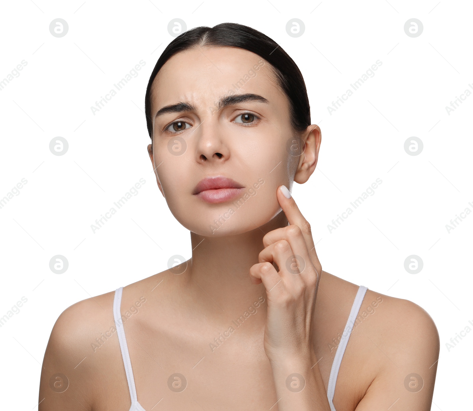 Photo of Young woman with dry skin on white background