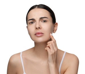 Young woman with dry skin on white background