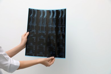 Photo of Doctor examining neck MRI image on light grey background, closeup