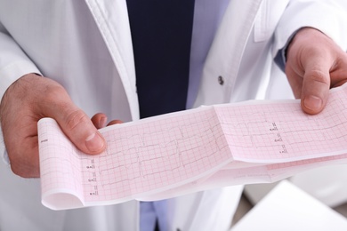 Doctor examining cardiogram in medical clinic, closeup