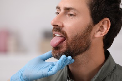 Photo of Doctor examining man`s oral cavity on blurred background, closeup. Space for text