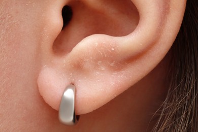 Photo of Woman with dry skin, closeup of ear