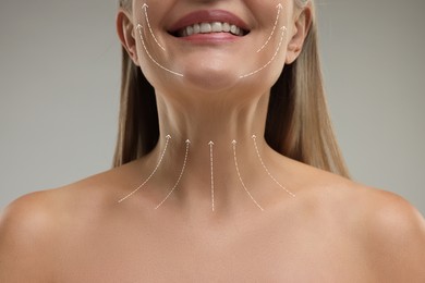 Image of Woman with perfect skin after cosmetic treatment on grey background, closeup. Lifting arrows on her neck and face