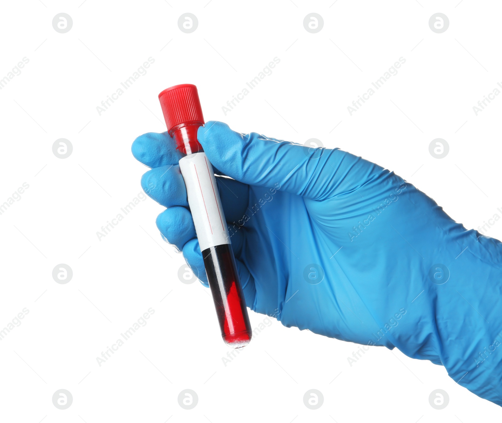 Photo of Laboratory worker holding test tube with blood sample for analysis isolated on white, closeup