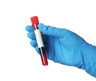 Laboratory worker holding test tube with blood sample for analysis isolated on white, closeup