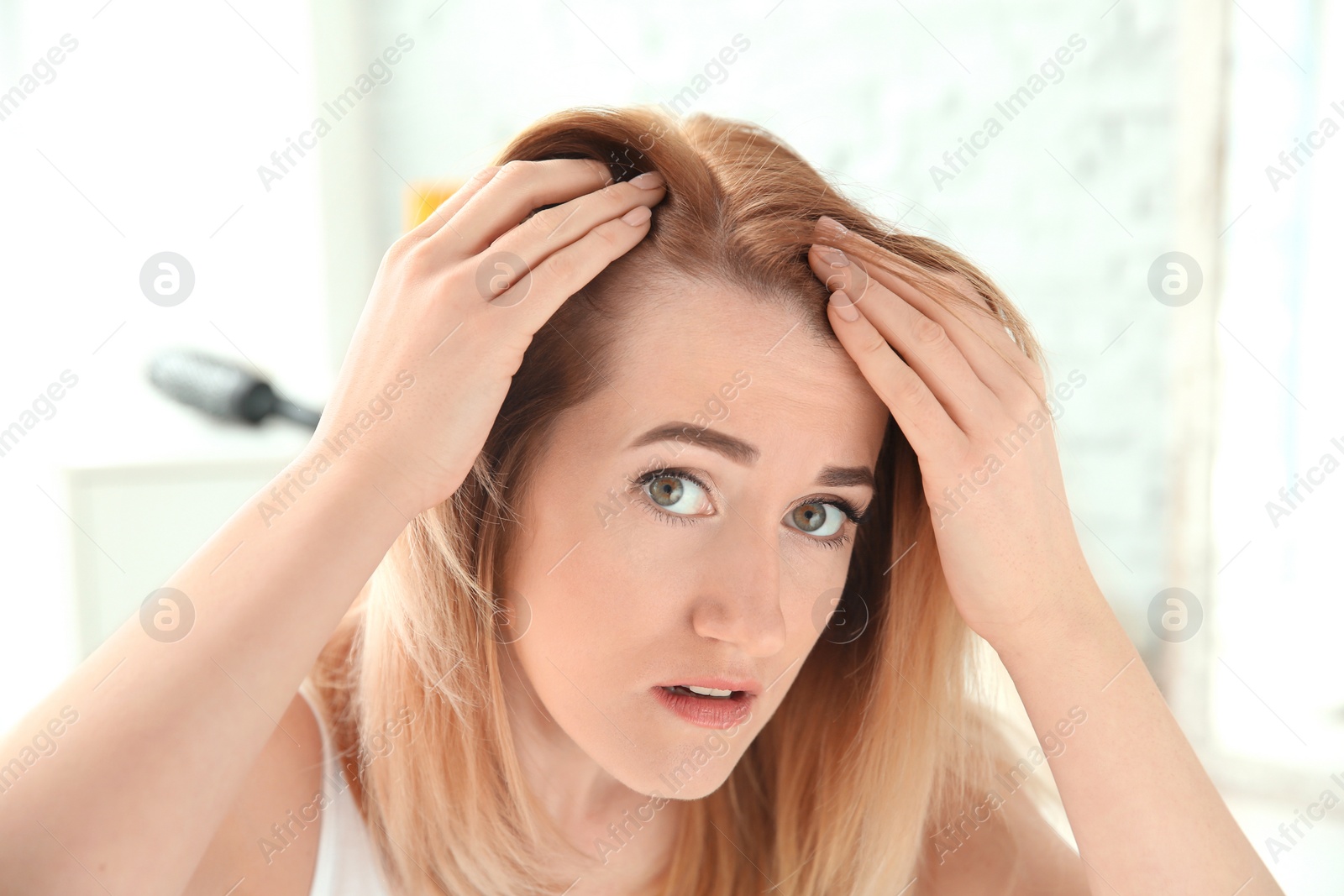 Photo of Young woman with hair loss problem at home