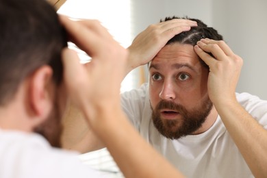 Photo of Man with dandruff in his dark hair near mirror indoors