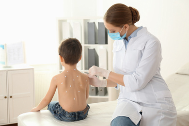 Photo of Doctor applying cream onto skin of little boy with chickenpox in clinic. Varicella zoster virus