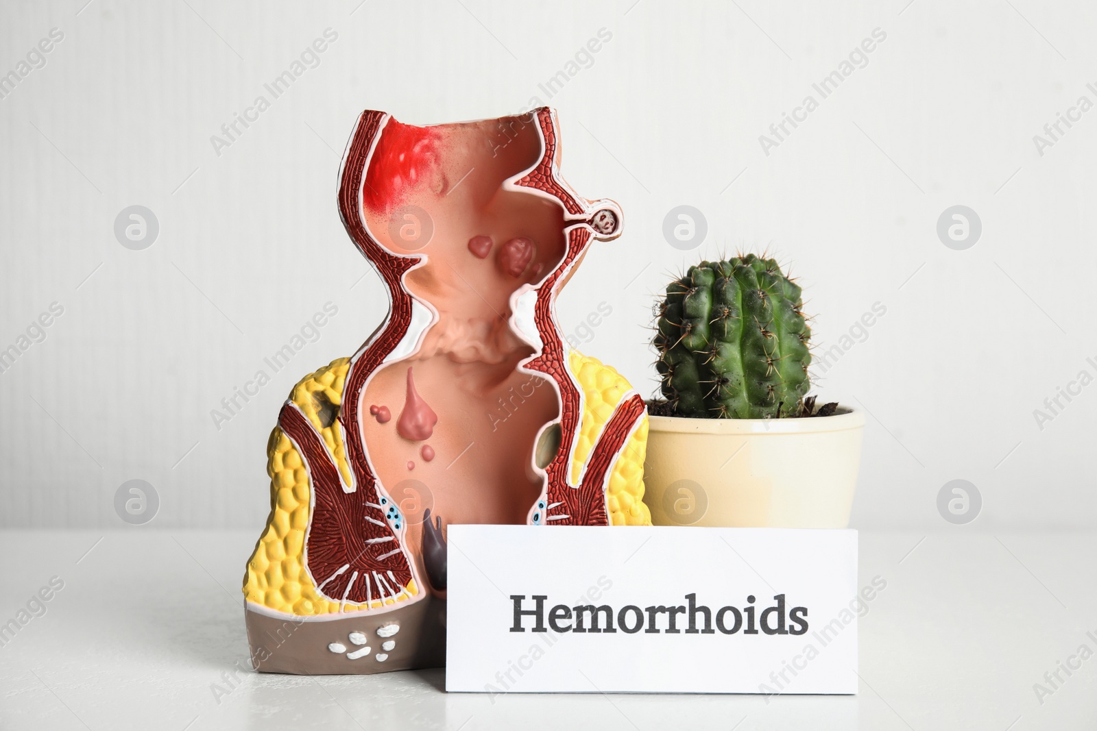 Photo of Model of unhealthy lower rectum, cactus and card with word Hemorrhoids on light background