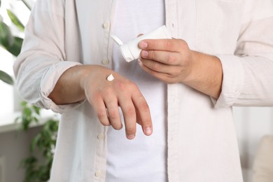 Photo of Man applying hand cream from tube at home, closeup