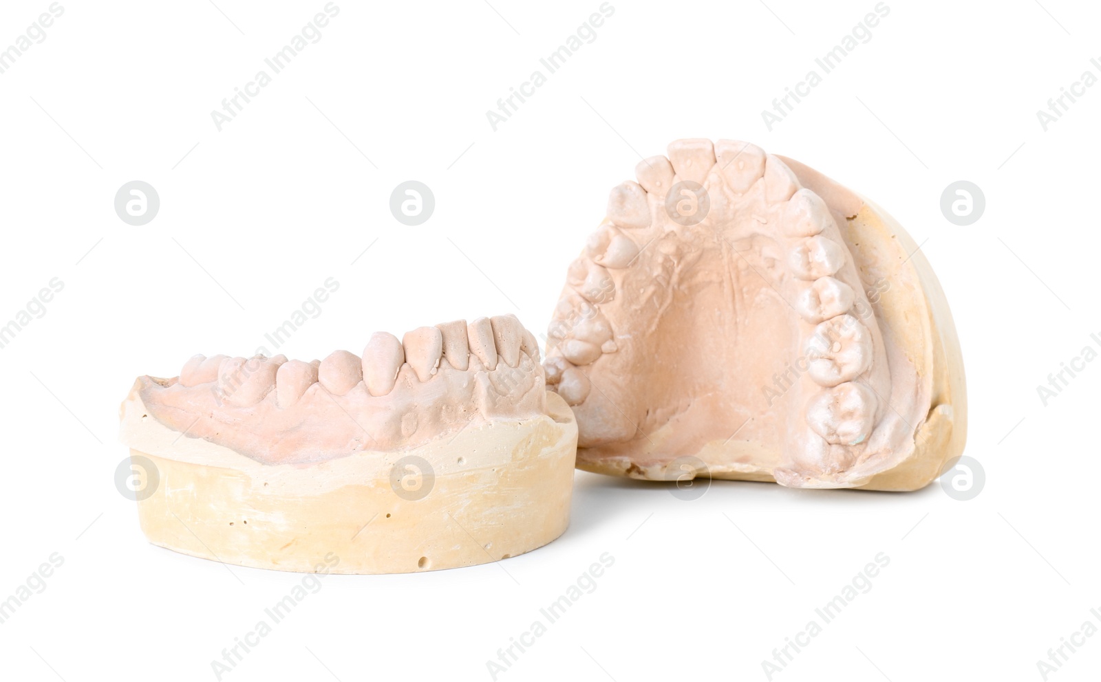 Photo of Dental model with jaws isolated on white. Cast of teeth