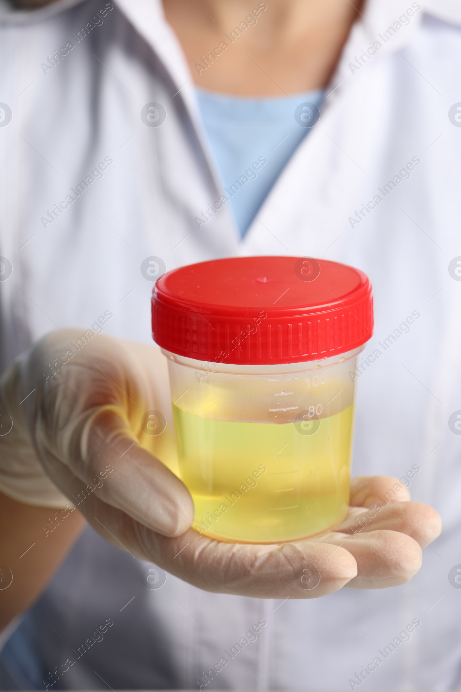 Photo of Doctor holding container with urine sample for analysis, closeup