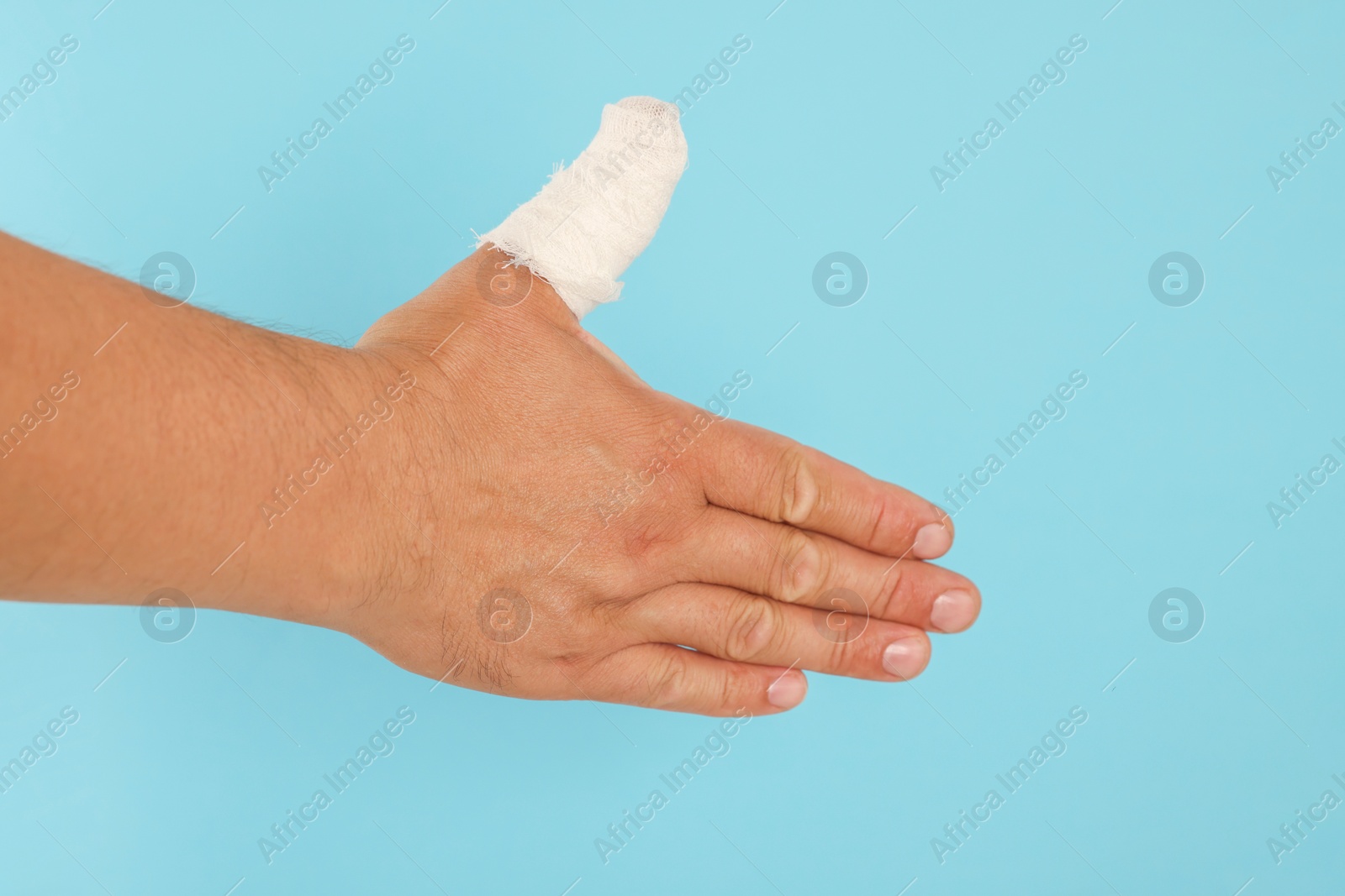 Photo of Man with thumb wrapped in medical bandage on light blue background, closeup