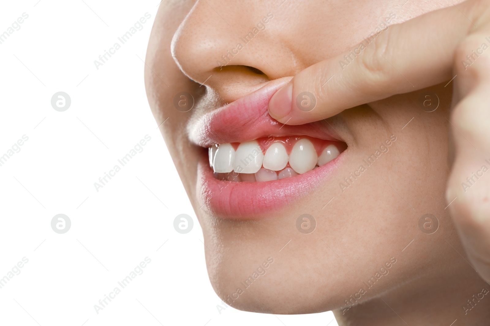 Photo of Woman showing healthy gums on white background, closeup