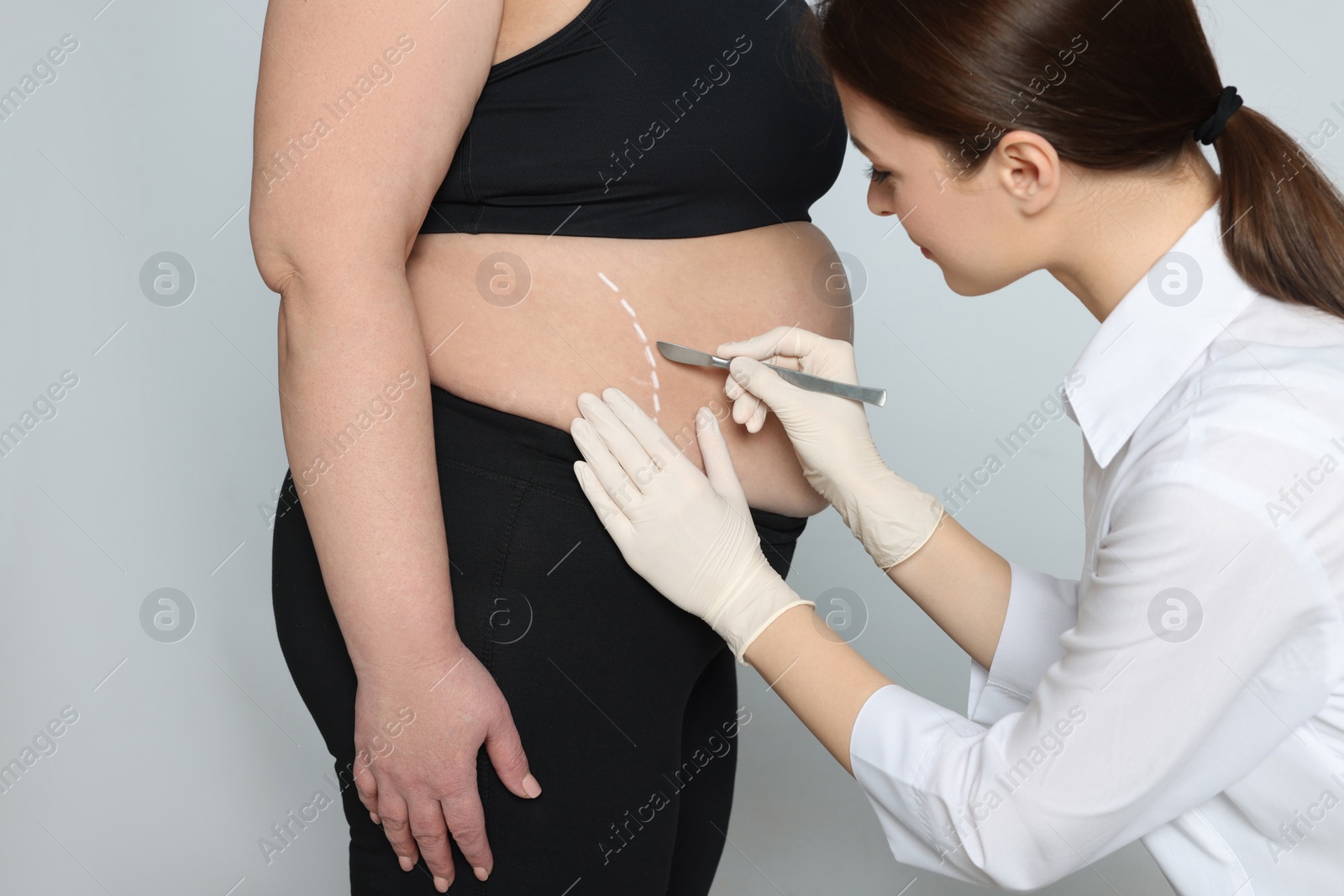 Photo of Doctor with scalpel near obese woman on light background. Weight loss surgery