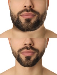 Image of Double chin problem. Collage with photos of man before and after plastic surgery procedure on white background, closeup
